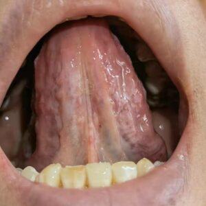tongue diagnosis